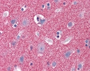 IHC testing of FFPE human cortex (brain) tissue with Septin 3 antibody at 3.75ug/ml. Required HIER: steamed antigen retrieval with pH6 citrate buffer; AP-staining.