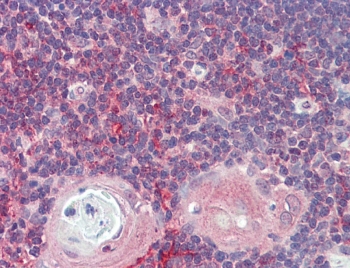 IHC testing of FFPE human thymus tissue with ARF4 antibody at 5ug/ml. Required HIER: steamed antig