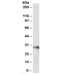 Western blot testing of pig kidney lysate with HOXA5 antibody at 1ug/ml. Predicted molecular weight: ~29kDa.