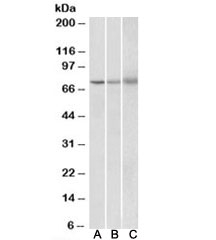 Western blot testing of human [A], mouse [B] and rat [C] spleen lysate with KLHL6 antibody at 2ug/ml. Predicted molecular weight: ~71kDa.