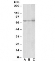 Western blot testing of human [A], mouse [B] and rat [C] spleen lysate with KLHL6 antibody at 2ug/ml. Predicted molecular weight: ~71 kDa.