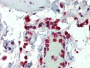 IHC testing of FFPE human colon tissue with p47phox antibody at 5ug/ml. Steamed antigen retrieval with citrate buffer pH 6, AP-staining.