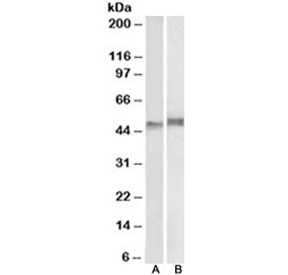 Western blot testing of mouse thymus (A) and pig spleen (B) lysate with p47phox antibody at 1ug/ml. Expected/observed molecular weight ~47kDa.