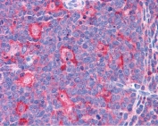 IHC testing of FFPE human tonsil tissue with TPD52L2 antibody at 3.75ug/ml. Required HIER: steamed antigen retrieval with pH6 citrate buffer; AP-staining.