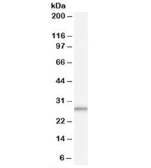 Western blot testing of human breast cancer lysate with TPD52L2 antibody at 0.1ug/ml. Predicted molecular weight: 25kDa.