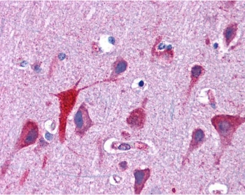 IHC testing of FFPE human brain (cortex) tissue with TPD52L2 antibody at 3.75ug/ml. Required HIER: steamed antigen retrieval with pH6 citrate buffer; AP-staining.