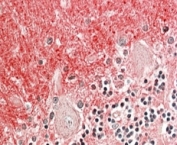 IHC staining of FFPE human cerebellum with GNB3 antibody at 4ug/ml. HIER: steamed with pH6 citrate buffer, AP-staining.