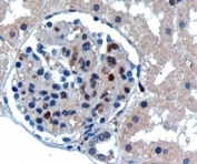 IHC staining of FFPE human kidney with UBE2I antibody at 0.3ug/ml.  HIER: microwaved with pH9 Tris/EDTA buffer, HRP-staining.