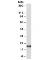 Western blot testing of human kidney lysate with UBE2I antibody at 0.5ug/ml. Predicted/observed molecular weight: ~17kDa. An NAP blocker was used in place of non-fat milk as blocking solution and diluent. (1)