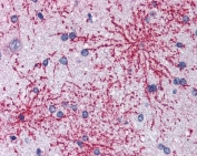 IHC testing of FFPE human brain (cortex) tissue with BAIAP2 antibody at 3.75ug/ml. Required HIER: steamed antigen retrieval with pH6 citrate buffer; AP-staining.