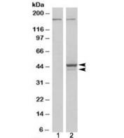 Western blot of HEK293 lysate overexpressing ELF3 probed with ELF3 antibody (mock transfection in lane 1). Predicted molecular weight: ~42/39kDa (isoforms 1/2).