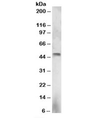 Western blot testing of NCI-H460 lysate with ELF3 antibody at 3ug/ml. Predicted molecular weight: ~42/39kDa (isoforms 1/2).~