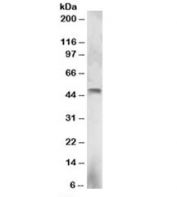 Western blot testing of NCI-H460 lysate with ELF3 antibody at 3ug/ml. Predicted molecular weight: ~42/39kDa (isoforms 1/2).