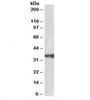 Western blot testing of human testis lysate with HSD17B3 antibody at 2ug/ml. Predicted molecular weight: ~34kDa.