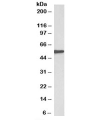 Western blot testing of human kidney lysate with EPHX2 antibody at 0.3ug/ml. Predicted molecular weight: ~57kDa.