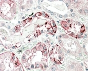 IHC staining of FFPE human kidney with CA12 antibody at 5ug/ml. HIER: steamed with pH6 citrate buffer, AP-staining.