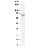 Western blot testing of human pancreas lysate with TRPV5 antibody at 1ug/ml. Predicted/observed molecular weight: ~85kDa.
