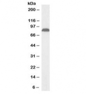 Western blot testing of human pancreas lysate with biotinylated TRPV5 antibody at 1ug/ml. Predicted/observed molecular weight: ~85kDa.