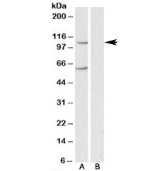 Western blot testing of human liver lysate with IRP2 antibody at 0.3ug/ml in the A) absence and B) presence of immunizing peptide. Predicted molecular weight ~105kDa. The ~60kDa band is likely a breakdown product of the protein.~