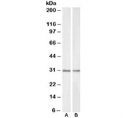 Western blot of rat (A) and pig (B) kidney lysate with NQO1 antibody at 1ug/ml. Predicted molecular weight ~30 kDa.