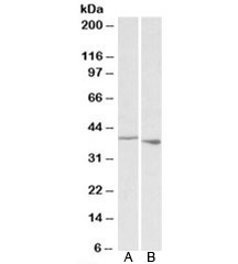 Western blot of rat A) spleen and B) thymus lysate with PCBP1 antibody at 0.1ug/ml. Predicted/observed molecular weight: