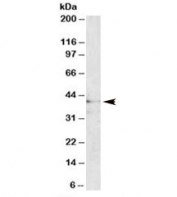 Western blot testing of human brain lysate with MC3R antibody at 1ug/ml. Predicted/observed molecular weight: ~40kDa.