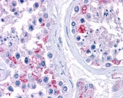 IHC testing of FFPE human testis tissue with RPL22 antibody at 3.75ug/ml. HIER: steamed with pH6 citrate buffer, AP-staining.