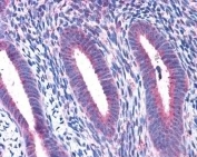 IHC testing of FFPE human uterus tissue with RPL22 antibody at 3.75ug/ml. HIER: steamed with pH6 citrate buffer, AP-staining.