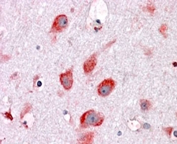IHC testing of FFPE human cortex with RPL22 antibody at 4ug/ml. HIER: steamed with pH6 citrate buffer, AP-staining.