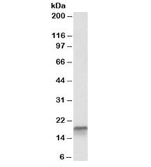 Western blot testing of K562 lysate with p18 antibody at 0.1ug/ml. Predicted molecular weight: ~20kDa, routinely observed at 18~20kDa.~