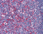 IHC testing of FFPE human tonsil tissue with Flotillin 2 antibody at 3.75ug/ml. Required HIER: steamed antigen retrieval with pH6 citrate buffer; AP-staining.