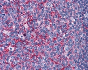 IHC testing of FFPE human tonsil tissue with Flotillin 2 antibody at 3.75ug/ml. Required HIER: steamed antigen retrieval with pH6 citrate buffer; AP-staining.