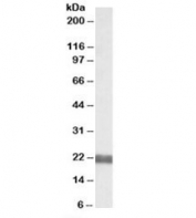 Western blot testing of rat pancreas lysate with UBEF2 antibody at 0.05ug/ml. Predicted molecular weight: ~21kDa.