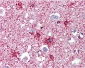 IHC testing of FFPE human brain (cortext) tissue with SEPT2 antibody at 2.5ug/ml. Required HIER: steamed antigen retrieval with pH6 citrate buffer; AP-staining.