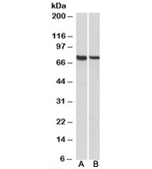 Western blot testing of mouse [A] and rat [B] spleen lysates with MUNC18-3 antibody at 1ug/ml. Predicted molecular weight: ~68kDa.