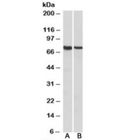 Western blot testing of mouse [A] and rat [B] spleen lysates with MUNC18-3 antibody at 1ug/ml. Predicted molecular weight: ~68kDa.