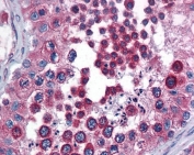 IHC staining of FFPE human testis with Calnexin antibody at 3.8ug/ml. HIER: steamed with pH6 citrate buffer, AP-staining.
