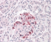 IHC testing of FFPE human pancreas with SOCS4 antibody at 4ug/ml. HIER: steamed with pH6 citrate buffer, AP-staining.
