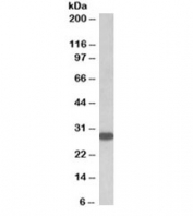 Western blot testing of human thyroid gland lysate with TSHR antibody at 0.5ug/ml. Predicted molecular weight: ~87kDa (long) and ~28kDa (short) forms.