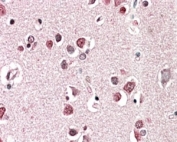 IHC staining of FFPE human cerebral cortex with SH3GL2 antibody at 5ug/ml. HIER: steamed with pH6 citrate buffer, AP-staining.