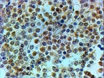 IHC testing of FFPE human spleen with TRIP antibody at 4ug/ml. HIER: steamed with pH6 citrate buffer, HRP-staining.