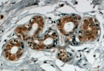 IHC staining of FFPE human breast with SNX5 antibody at 4ug/ml. HIER: steamed with pH6 citrate buffer, HRP-staining.