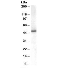Western blot testing of Jurkat lysate with SNX5 antibody at 1ug/ml. Predicted/observed molecular weight: ~48kDa.~