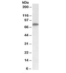 Western blot testing of HepG2 lysate with Arginyl-tRNA synthetase antibody at 1ug/ml. Predicted/observed molecular weight: ~75kDa.