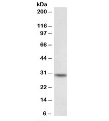 Western blot testing of peripheral blood lymphocyte lysate with HOXC8 antibody at 0.1ug/ml. Predicted molecular weight: ~28kDa.~