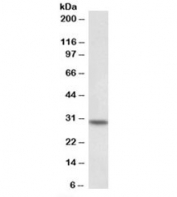 Western blot testing of peripheral blood lymphocyte lysate with HOXC8 antibody at 0.1ug/ml. Expected molecular weight: 27-35 kDa.