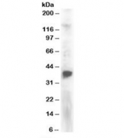 Western blot testing of Jurkat lysate with PINX antibody at 2ug/ml. Predicted molecular weight: ~37kDa.