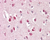 IHC testing of FFPE human brain (cortex) tissue with BAIAP2 antibody at 3.75ug/ml. Required HIER: steamed antigen retrieval with pH6 citrate buffer; AP-staining.