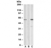 Western blot testing of HEK293 lysate over expressing human BAIAP2-FLAG probed with BAIAP2 antibody (1 ug/ml) in Lane A and with anti-FLAG (1/3000) in lane C. Mock-transfected HEK293 probed with anti-BAIAP2 (1ug/ml) in Lane B. Predicted molecular weight: ~57 kDa.