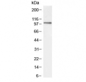 Western blot testing of mouse NIH3T3 lysate with ICAM1 antibody at 2ug/ml. Predicted molecular weight: ~58/75-115 kDa (unmodified/glycosylated).